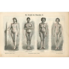 1895 Nude Women Body Types German Miranha Indian Australian Arab Engraving Print